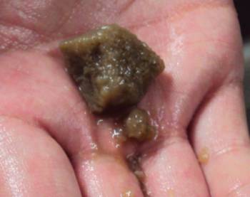 301.有機物污染后的樹脂 .jpg